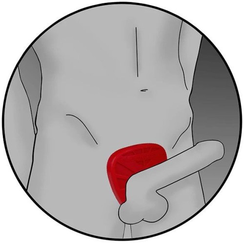 ElectraStim Silicone Fusion Viper Cock Ring